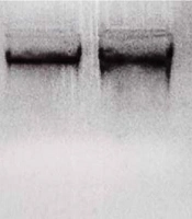 Gene Cell Tissue